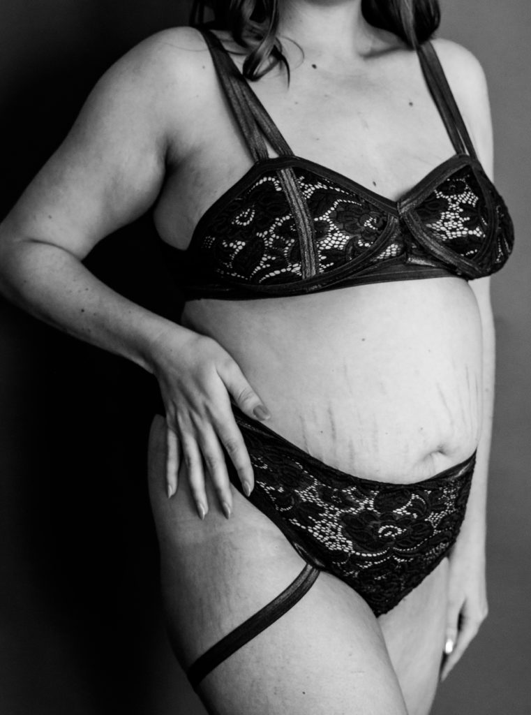 boudoir photos of stretch marks and scars